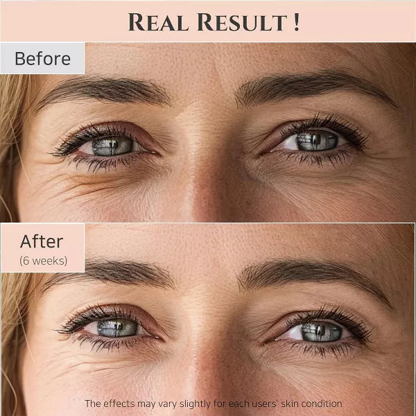 Beauty of Joseon Korean Skincare Revive Eye Serum for Anti-Aging and Firming the Eye Area with Ginseng + Retinal - 30ml